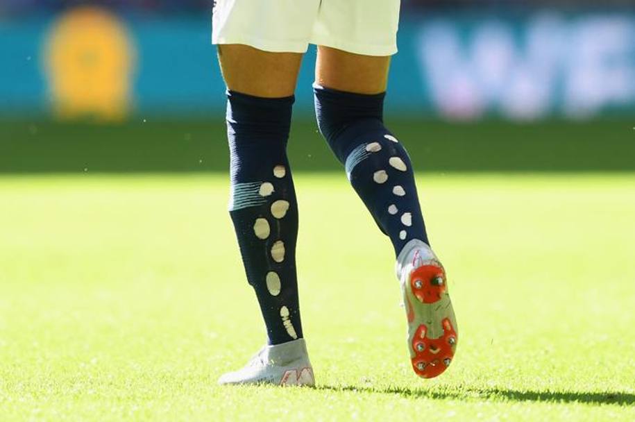 I calzettoni bucati di un giocatore del City. Afp